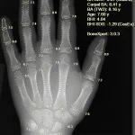 Dirbtinis intelektas gali tapti galingu įrankiu kovojant su širdies ligomis