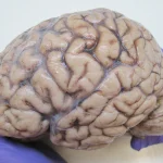 Mokslininkai atrado paslėptą 'nutekėjimą' žmogaus smegenyse