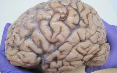 Mokslininkai atrado paslėptą 'nutekėjimą' žmogaus smegenyse