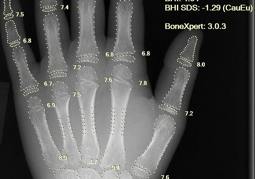 Dirbtinis intelektas sveikatos priežiūros srityje: ar chatbotai gali būti sprendimas?