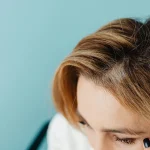 Migrena: kaip hormonai, mityba ir miegas veikia galvos skausmus