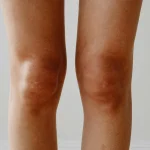 Revoliucinė genų terapija: vienas šūvis atkuria klausą per kelias savaites